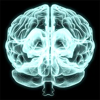 brain after